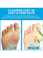 Sumifun – Foot Anti-Bacterial Cream